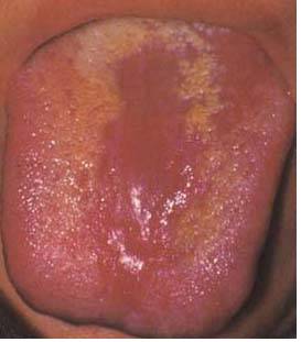 62 High-Definition Tongue Diagnosis Charts with Illustrations (Collector's Edition)