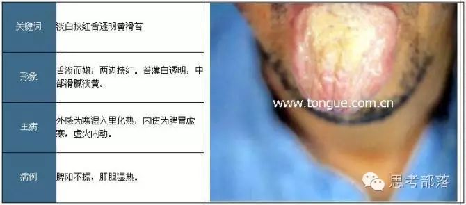 Comprehensive Guide to Tongue Diagnosis (8): 72 Types of Tongue Diagnosis Charts