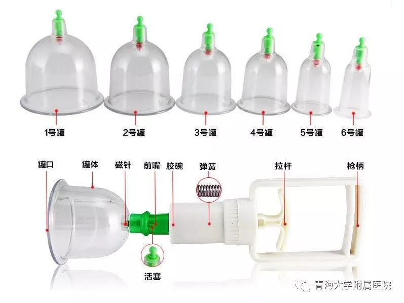 Understanding the Technique of Pricking and Cupping Therapy