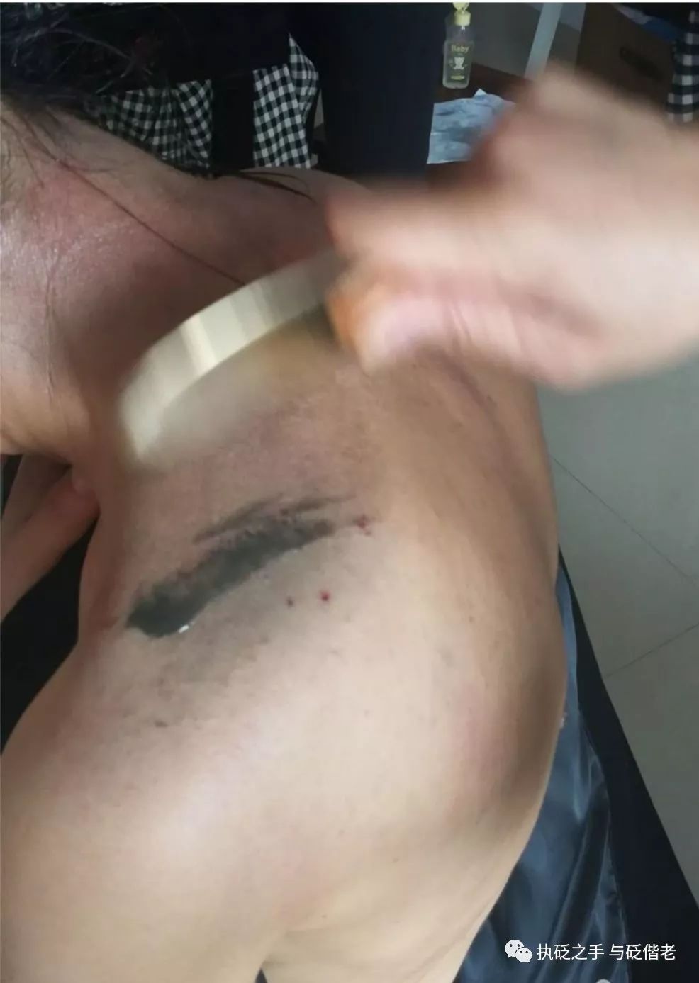 Black Sha: The Surprising Discovery of Copper Gua Sha
