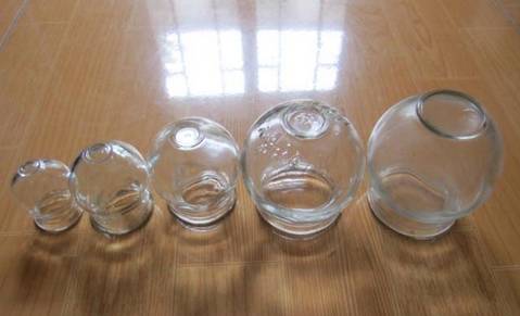 Cupping Therapy: Unblocking Meridians, Promoting Qi and Blood Circulation!