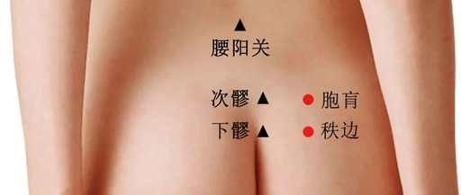 Traditional Fine Needle Technique for Acupuncture Treatment of Sciatica