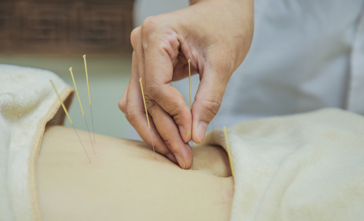 Balancing Yin and Yang in the Body: Preventing Disease and Treating Existing Conditions with Traditional Chinese Medicine Acupuncture
