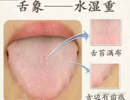 Comprehensive Guide to Tongue Diagnosis (Tongue Manifestations)