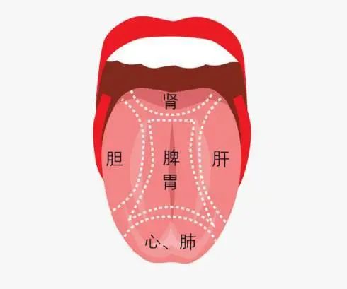 Understanding Health Through Tongue Observation: It's Not as Difficult as You Think