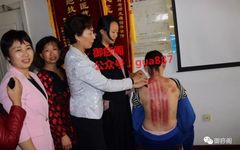 Why Gua Sha Should Not Be Limited to the Back: The Wonders of Gua Sha