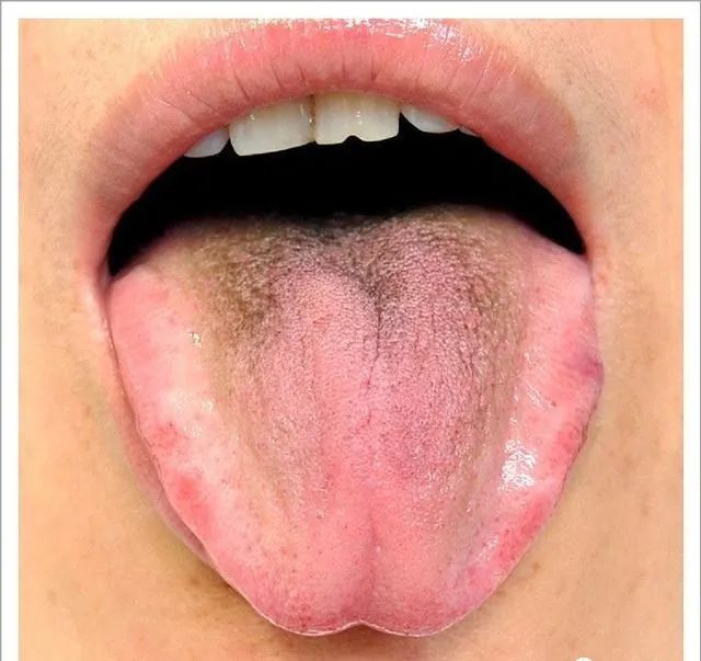 Traditional Chinese Medicine Tongue Diagnosis: 26 Clinical High-Definition Tongue Diagnosis Images with Analysis