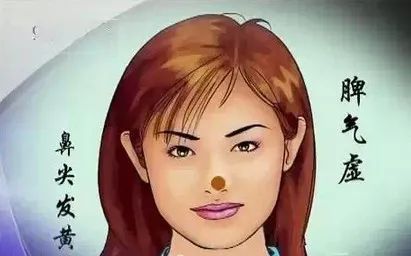 Comprehensive Guide to Facial Diagnosis in Traditional Chinese Medicine (With Images and Explanations)