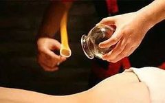 The Therapeutic Use of Cupping in Traditional Chinese Medicine: Promoting Qi and Blood Circulation, Strengthening the Body and Expelling Pathogens