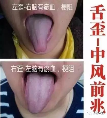 Tongue Diagnosis: A Clear Insight