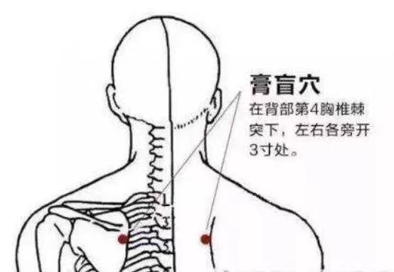 Understanding Gua Sha: What Is It Really About?