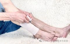 Injury from Falls and Blunt Trauma