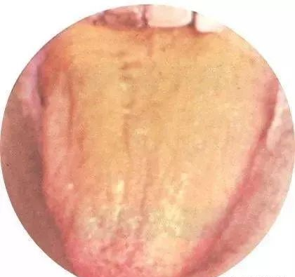 130 High-Definition Tongue Diagnosis Charts (Recommended for Collection)