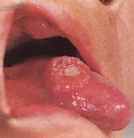 62 High-Definition Tongue Diagnosis Charts with Illustrations (Collector's Edition)