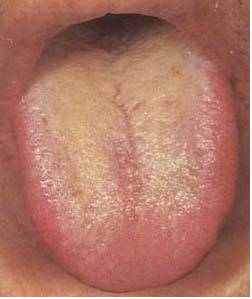 62 High-Definition Tongue Diagnosis Charts with Illustrations (Collector's Edition)