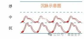 Analysis of Deep Pulse: Body Image, Main Diseases, and Associated Pulses