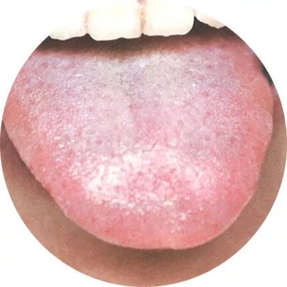 Comprehensive Guide to Tongue Diagnosis: A Must-Collect!