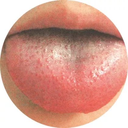 The Most Comprehensive High-Definition Real Tongue Diagnosis: Observing Tongue Patterns to Understand Internal Organs (Collection Edition)