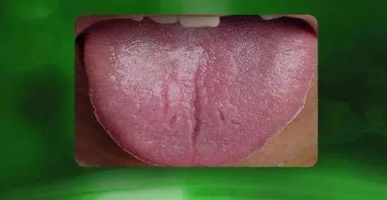 The TCM Tongue Diagnosis Atlas is Here! Observe the Tongue to Understand the Whole Body!