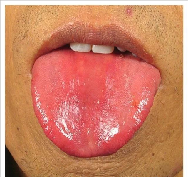 Traditional Chinese Medicine Tongue Diagnosis: 26 Clinical High-Definition Tongue Diagnosis Images with Analysis