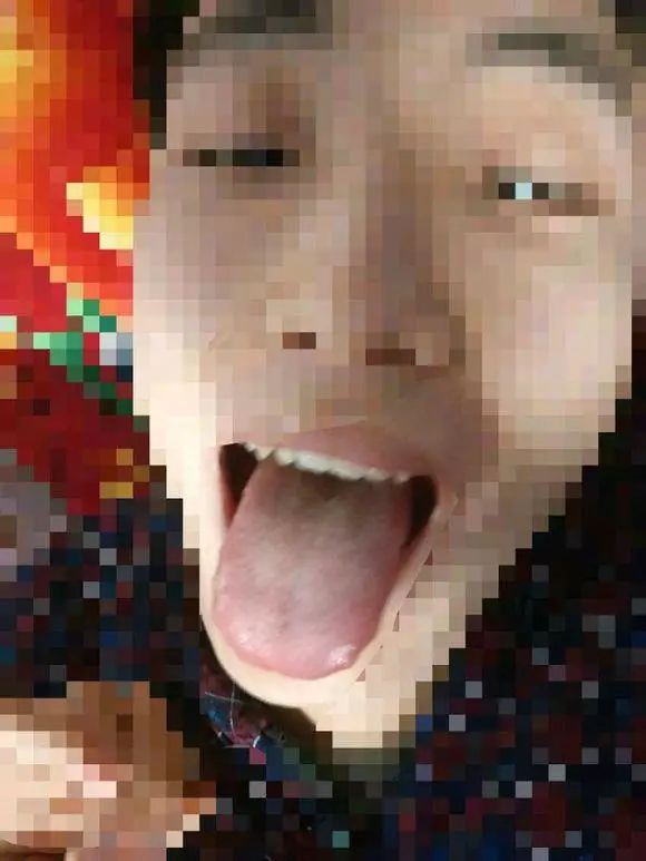 Precious Tongue Diagnosis: Identifying Stomach Yin Deficiency, Severe Yin Fluid Deficiency, Liver Blood Deficiency, and Yang Deficiency with Insufficient Qi and Blood
