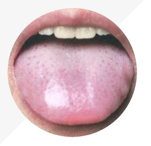 Understanding Tongue Diagnosis in TCM: Insights into Health from Tongue Appearance (Part 2)