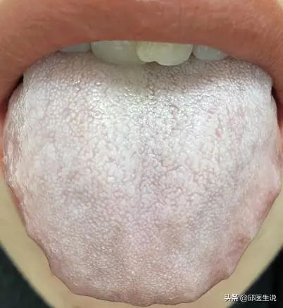 Understanding Different Types of Dampness in Traditional Chinese Medicine: Cold Damp, Damp Heat, Phlegm Damp, and More