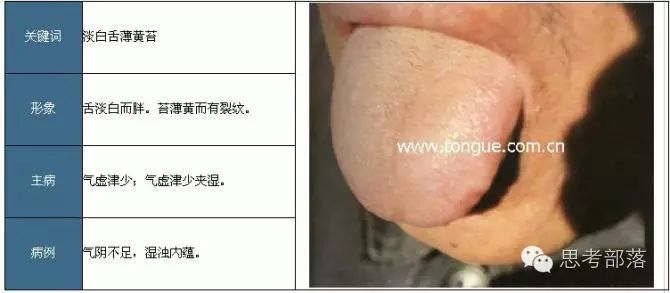 Comprehensive Guide to Tongue Diagnosis (8): 72 Types of Tongue Diagnosis Charts