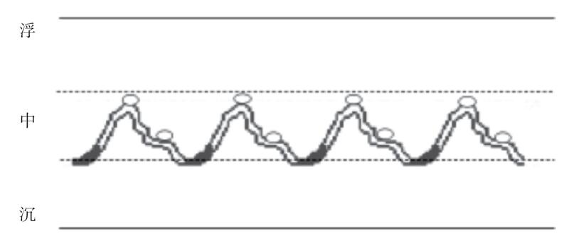 The Significance of Slippery Pulse Beyond Pregnancy Indication