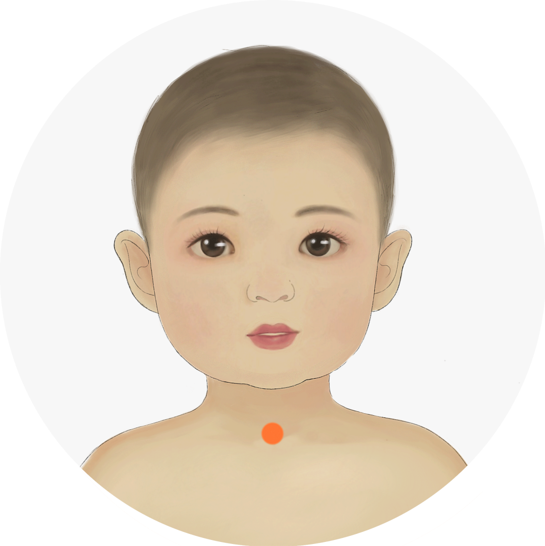 Differentiating Coughs: Cold, Heat, and Dryness for Effective Treatment