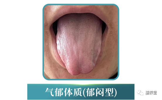 The Nine Constitutions in Traditional Chinese Medicine: Which One Are You?