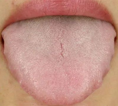 The Efficacy, Functions, and Contraindications of Astragalus (Huang Qi)