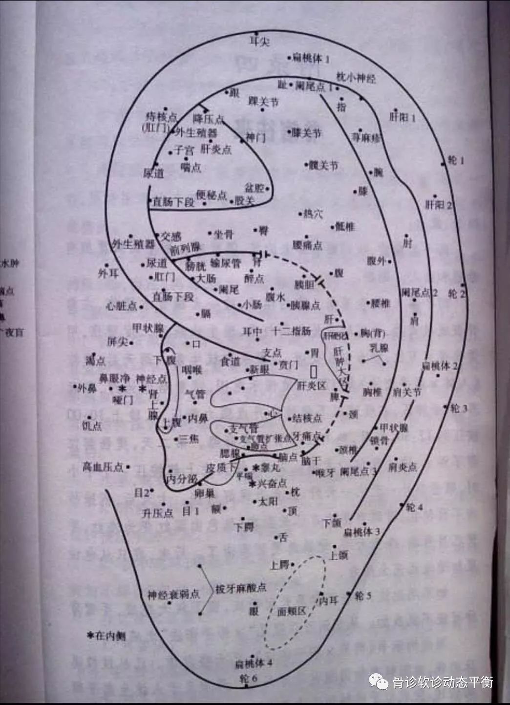 The Scope and Boundaries of the Efficacy of Fine Needling
