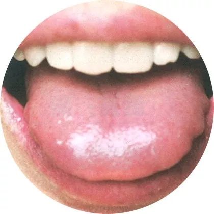 The Most Comprehensive High-Definition Real Tongue Diagnosis: Observing Tongue Patterns to Understand Internal Organs (Collection Edition)