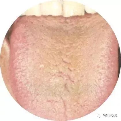 Learn Quick Ways to Observe Tongue Quality and Coating to Understand Your Health and Diseases!