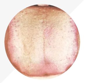Analysis of High-Definition Tongue Diagnosis Charts: Understanding Health Through Your Tongue (Part 1)