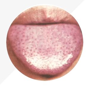 Analysis of High-Definition Tongue Diagnosis Charts: Understanding Health Through Your Tongue (Part 1)