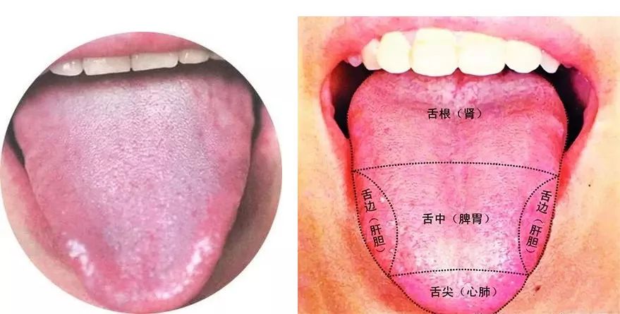 No More Worries About Liver Qi Stagnation! Moxibustion Can Help Relieve Your Concerns!
