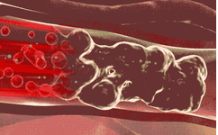 Traditional Chinese Medicine Insights: Improving Blood Stasis in Women