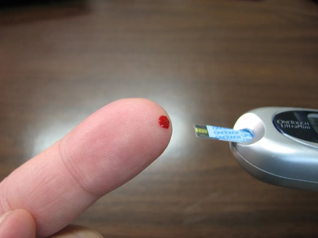 Red Dates and Brown Sugar Do Not Nourish Blood! Here Are 5 Foods That Truly Supplement Blood, Don't Waste Your Money
