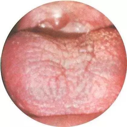 The TCM Tongue Diagnosis Atlas is Here! Observe the Tongue to Understand the Whole Body!