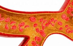 Characteristics of Blood Stasis and How to Regulate It