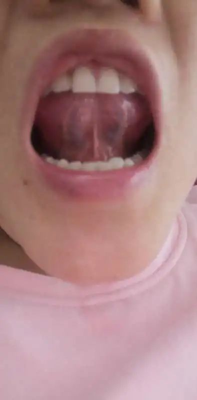 Inheritance of Traditional Chinese Medicine at Zhigu Tang | Basic Theory of TCM Lesson 34 (Tongue Diagnosis: Tongue Color)