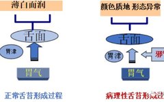 Understanding Disease Through Tongue Diagnosis in Traditional Chinese Medicine
