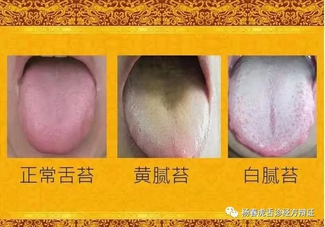 Foundations of Traditional Chinese Medicine: Phlegm-Dampness