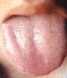 Comprehensive Guide to Tongue Diagnosis: Easily Understand Your Health Condition