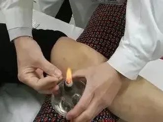 The Powerful Energy of Fire Needles