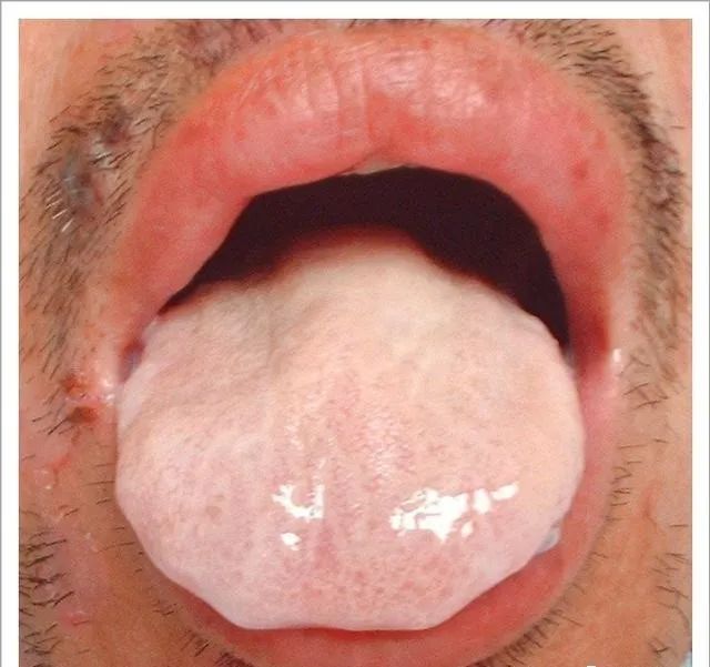 Traditional Chinese Medicine Tongue Diagnosis: 26 Clinical High-Definition Tongue Diagnosis Images with Analysis