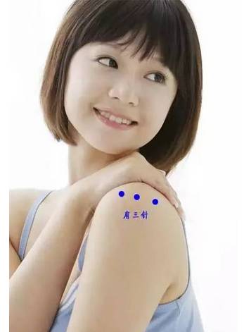 The Miraculous "Three Needles" in TCM Acupuncture: Treating One Disease with Three Acupuncture Points