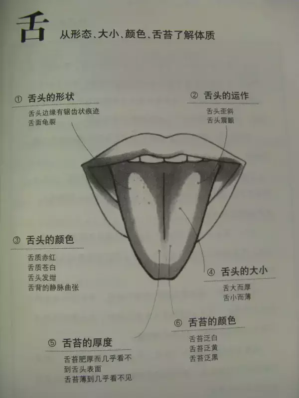 Essence of TCM Observation Diagnosis Illustrated
